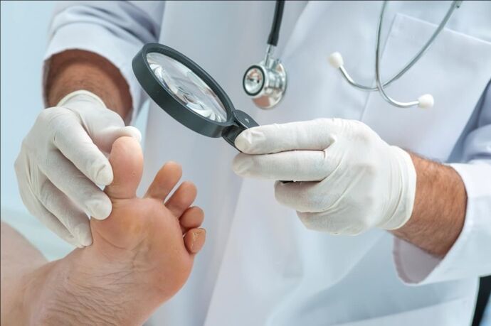 Before prescribing treatment for nail fungus, the doctor will conduct an examination