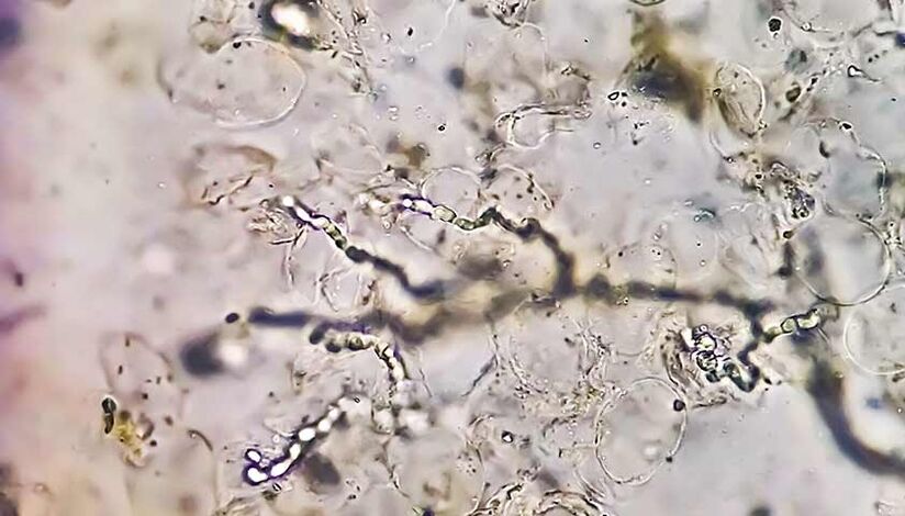 Fungi under the microscope – responsible for the development of foot fungus